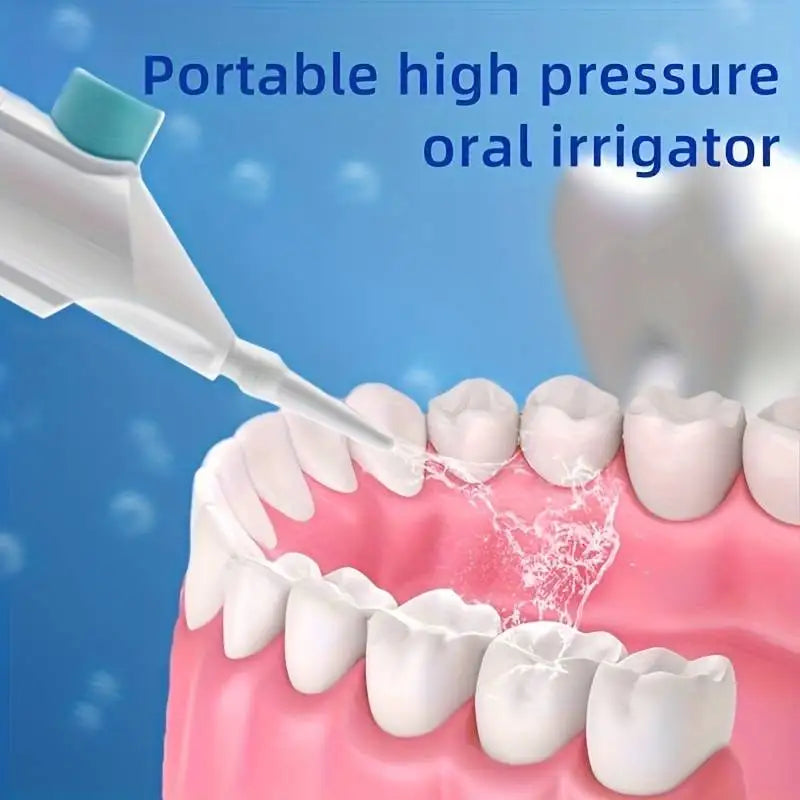 Portable High-Pressure Water Flosser for Teeth Cleaning