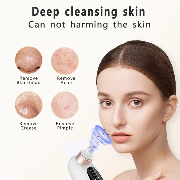 Blackhead Remover Vacuum – Pore Deep Cleaner with Hydrating Spray