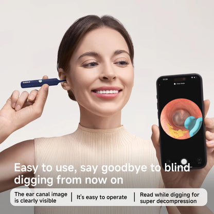 Bebird Earsight Plus Smart Earwax Removal Kit – All-in-One Visual Ear Cleaner